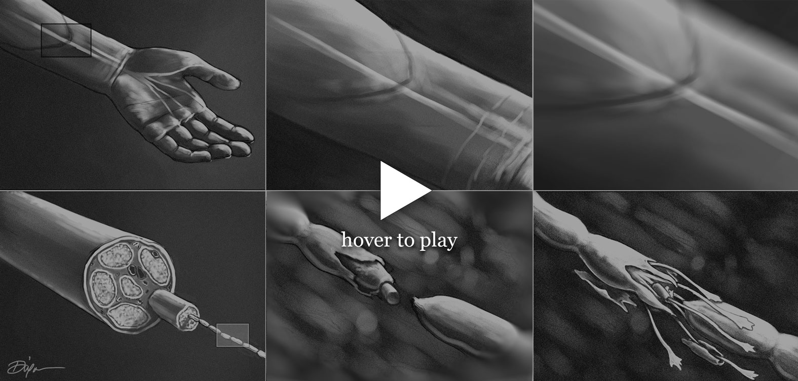 Peripheral nerve regeneration storyboard — hover to play